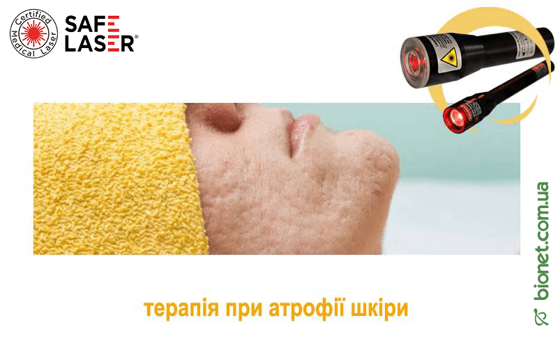 Терапія при атрофії шкіри, Safe Laser | Bionet, Biyovis